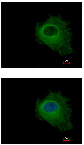 Immunofluorescent analysis of methanol-fixed HeLa cells labeling Nucleoside phosphorylase with ab154257 at 1/500 dilution. Lower panel co-stained with Hoechst 33342.
