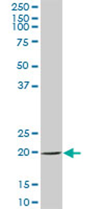 Anti-SAT2 antibody (ab70429) at 1/500 dilution + human placenta tissue lysate at 25 µgSecondaryGoat Anti-Mouse IgG (H&L)-HRP Conjugate at 1/2500 dilution