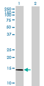 All lanes : Anti-SAT2 antibody (ab70429) at 1/500 dilutionLane 1 : SAT2 transfected 293T cell lysateLane 2 : Non-transfected 293T cell lysateLysates/proteins at 25 µg per lane.SecondaryGoat Anti-Mouse IgG (H&L)-HRP Conjugate at 1/2500 dilution
