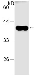 Anti-Nucleoside phosphorylase antibody [11] (ab80225) at 1/1000 dilution + recombinant NP protein