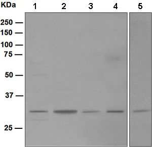 All lanes : Anti-Nucleoside phosphorylase antibody [EPR5715] (ab109447) at 1/1000 dilutionLane 1 : Jurkat lysateLane 2 : JAR lysateLane 3 : K562 lysateLane 4 : Human placenta lysateLane 5 : 293T lysateLysates/proteins at 10 µg per lane.