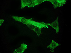 ab109447 at 1/100 dilution staining Nucleoside phosphorylase in SH SY5Y cells by Immunofluorescence.