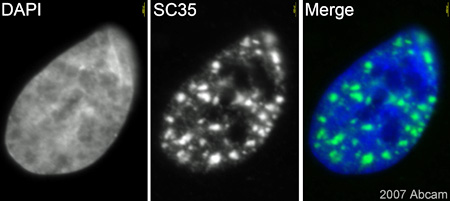 ab11826 (1/1000) staining SC35 (phospho) in Human retinal pigment epithelial (RPE) cells (green). Cells were fixed in paraformaldehyde, permeabilised with 0.5% Triton X-100/PBS and counterstained with DAPI in order to highlight the nucleus (blue). Please refer to abreview for further experimental details.See Abreview