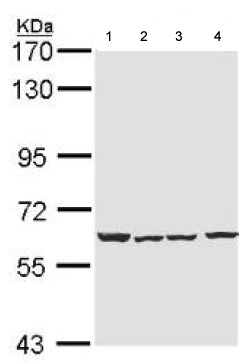 All lanes : Anti-Nicotinic Acetylcholine Receptor alpha 4 antibody (ab151596) at 1/1000 dilutionLane 1 : 293T whole cell lysateLane 2 : H1299 whole cell lysateLane 3 : HepG2 whole cell lysateLane 4 : MOLT4 whole cell lysateLysates/proteins at 30 µg per lane.