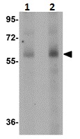 Lane 1 :  Anti-Scavenging Receptor SR-BI antibody (ab106572) at 1 µg/mlLane 2 :  Anti-Scavenging Receptor SR-BI antibody (ab106572) at 2 µg/mlLane 1 : Human spleen tissue lysateLane 2 : Human spleen tissue lysateLysates/proteins at 15 µg per lane.