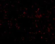Immunofluorescence of SCARB1 in Human Spleen cells using ab106572 at 20 ug/ml.