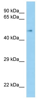 Anti-Scavenging Receptor SR-BI antibody (ab125433) at 1 µg/ml + Human fetal kidney lysate at 10 µg