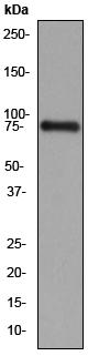 Anti-Scavenging Receptor SR-BI antibody [EP1556Y] (ab52629) at 1/2000 dilution + Mouse liver lysate at 10 µgSecondarygoat anti-rabbit HRP at 1/2000 dilutionObserved band size : 80 kDa (why is the actual band size different from the predicted?)