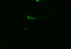 ab65160 staining SCN11A in human sperm cells by Immunocytochemistry/ Immunofluorescence.Sperm cells were washed, re-suspended in phosphate-buffered saline and smeared onto poly-L-lysine-coated slides. Spermatozoa were then fixed by incubation in cold methanol (-20°C) for 20 minutes. Slides were washed three times for 10 minutes with PBS and incubated with 2% BSA in PBS for 30 minutes to block non-specific sites. Test slides were incubated with ab65160 at a 1/100 dilution. Samples were washed three times in PBS, and incubated for 60 minutes with appropriate FITC-conjugated secondary antibodies. Slides were further washed in PBS, mounted using Vectashield and examined with a Olympus BX-51 fluorescence microscopy using a 100× immersion objective.