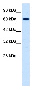 Anti-SCNN1B antibody (ab28668) at 0.125 µg/ml + Jurkat cell lysates
