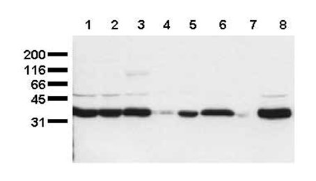 All lanes : Anti-Scramblase 1 antibody [1E9] (ab24923) at 0.5 µg/ml (Whole cell lysates of serum starved tumor cells were applied to SDS-PAGE and transferred to a PVDF membrane)Lane 1 : HeLaLane 2 : HepG2Lane 3 : HEK-293Lane 4 : SY5YLane 5 : JurkatLane 6 : U937Lane 7 : K562Lane 8 : THPLysates/proteins at 20000 cells per lane.SecondaryA HRP-conjugated antibodydeveloped using the ECL technique