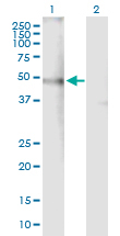 All lanes : Anti-Nicotinic Acetylcholine Receptor alpha 4 antibody (ab167556) at 1 µg/mlLane 1 : Nicotinic Acetylcholine Receptor alpha 4 transfected 293T cell line lysateLane 2 : Non-transfected 293T cell line lysateLysates/proteins at 15 µl per lane.