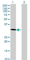 All lanes : Anti-SCYL1BP1 antibody (ab72921) at 1/500 dilutionLane 1 : 293T cell lysate transfected with SCYL1BP1Lane 2 : Non-transfected 293T cell lysateLysates/proteins at 25 µg per lane.SecondaryGoat Anti-Mouse IgG (H&L)-HRP Conjugate at 1/2500 dilutionObserved band size : 27 kDa (why is the actual band size different from the predicted?)