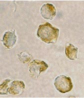 ab25959 at 2µg/ml staining Nudel in Jurkat cells by ICC/IF