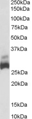 Anti-SDHB antibody (ab39988) at 0.003 µg/ml (for 1 hour) + Human Liver lysate in RIPA buffer at 35 µgdeveloped using the ECL technique