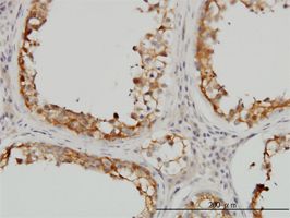 SDSL antibody (ab57706) used in immunohistochemistry at 3ug/ml on formalin fixed and paraffin embedded human testis.