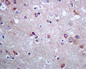 Immunohistochemical analysis of paraffin-embedded Human brain tissue labelling SEC14L2 with ab137013 at 1/250 dilution.