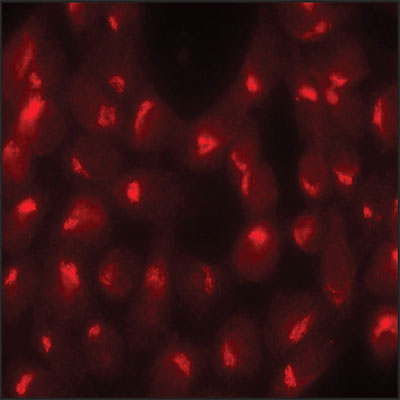 Human HeLa cells were fixed and permeabilized with methanol followed by acetone. Fixed cells were stained with 5 µg/mL Anti-Sec23 antibody. The antibody was developed with Goat Anti-Rabbit IgG, Cy3 conjugate.