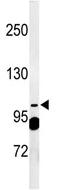 Anti-SEC24A antibody (ab102660) at 1/100 dilution + T47D cell line lysate at 12.5 µg