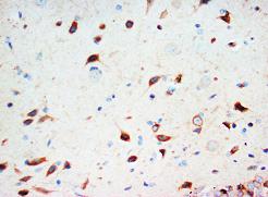ab65821, at 0.5µg/ml, staining Secretogranin 3 in the cytoplasm of paraffin embedded rat brain tissue sections.