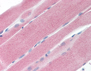 ab118496 at 10 &microg/ml staining Secretory phospholipase A2 Type V in Human Skeletal Muscle by Immunohistochemistry Formalin-fixed, Paraffin-embedded tissue.