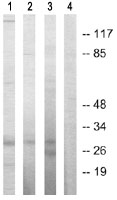 All lanes : Anti-Securin antibody (ab64930) at 1/500 dilutionLane 1 : Extracts from 293 cellsLane 2 : Extracts from Jurkat cellsLane 3 : Extracts from HepG2 cellsLane 4 : Extracts from HepG2 cells with immunising peptide at 10 µgLysates/proteins at 30 µg per lane.