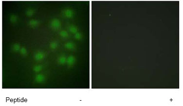 ab64930, at a 1/500 dilution, staining Human Securin in HUVEC cells, by Immunofluorescence, with (+) or without (-) immunising peptide