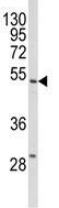 Anti-Selenium Binding Protein 1 antibody - C-terminal (ab175884) at 1/1000 dilution + HL60 cell lysate at 35 µg