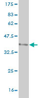 Western blot against tagged recombinant protein immunogen using ab56662 SEMA4B antibody at 1ug/ml.