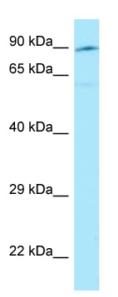 Anti-Semaphorin 3E antibody (ab128619) at 1 µg/ml + 721_B cell lysate at 10 µg