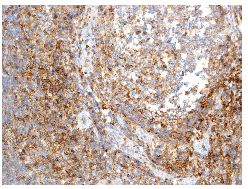 Immunohistochemical analysis of paraffin embedded Human tonsil tissue labelling Semaphorin 4D with ab134128 at 1/100 dilution