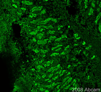ab51957 (1/200) detecting Semaphorin 5A in Chicken E11 embryo. Tissue was fixed in paraformaldehyde, permeabilised with 0.2% Triton X-100/PBS and blocked in 5% serum for 1 hour at 37oC. Incubation with primary antibody was performed for 16 hours in 0,5% BSA/ 2,5% serum/ PBS at 4oC. Please refer to abreview for further experimental details.See Abreview