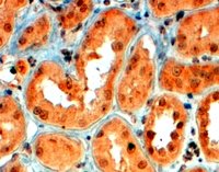 ab51957 at 4µg/ml staining Semaphorin 5A in Human kidney tissue by Immunohistochemistry (Formalin/PFA-fixed paraffin-embedded sections). Steamed antigen retrieval with citrate buffer pH 6 was performed. Antibody was detected by HRP-staining.