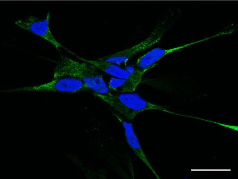 Immunofluorescence analysis of Human Glioblastoma multiforme cells, staining Semaphorin 5A with ab51957. Cells were fixed in 3% paraformaldehyde, permeabilized with 0.5% Triton X-100 and blocked with pure goat serum for 30?min on ice. Samples were incubated with primary antibody for 2 hours on ice. An AlexaFluor®488-conjugated anti-goat IgG was used as the secondary antibody.