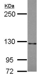 Anti-Semaphorin 5A antibody (ab127033) at 1/2000 dilution + U87-MG whole cell lysate at 30 µg