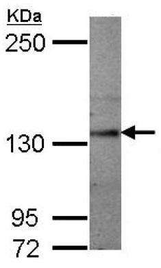 Anti-Semaphorin 5A antibody (ab127002) at 1/1000 dilution + Mouse brain whole cell lysate at 50 µg