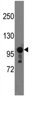 Anti-Semaphorin 5A antibody (ab70981) at 1/60 dilution + mouse brain lysate at 35 µg
