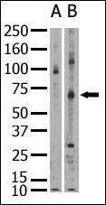 Western blot analysis SENP 1 in whole HL60 cell lysate. SENP1 (Arrow) was detected using ab3656 (Lane B) but not pre-immune serum (lane A). Secondary HRP-anti-rabbit was used for signal visualization with chemiluminescence.