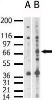 Western blot analysis of SENP 1 in whole HL60 cell lysate using ab3657 (Lane B) but not pre-immune serum (lane A). Secondary HRP-anti-rabbit was used for signal visualization with chemiluminescence.