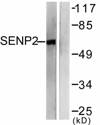 All lanes : Anti-SENP2 antibody (ab58418) at 1/500 dilutionLane 1 : MDA-MB-435 cell extractLane 2 : MDA-MB-435 cell extract with immunizing peptide