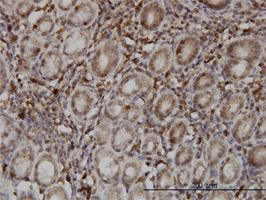 SENP6 antibody (ab57239) used in immunohistochemistry at 3ug/ml on formalin fixed and paraffin embedded human stomach.
