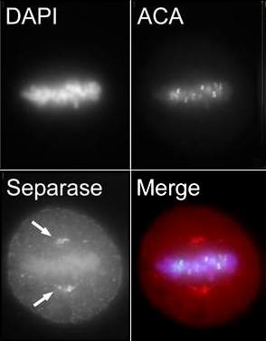 Metaphase HeLa cells were labelled with anti-ACA (anti-centromeric antigen) and anti-Separase (ab3762). ab3762 was used at a working concentratin of 1µg/ml. The arrows indicate the position of the centrosomes and demonstrate a spatial relationship between Separase and the centrosomes during metaphase. In the final panel DAPI is pseudo-coloured blue, while ACA and Separase are green and red respectively. 100x magnification. 