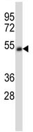 Anti-Nicotinic Acetylcholine Receptor alpha 5 antibody (ab116538) at 1/100 dilution + A549 cell line lysate at 35 µg