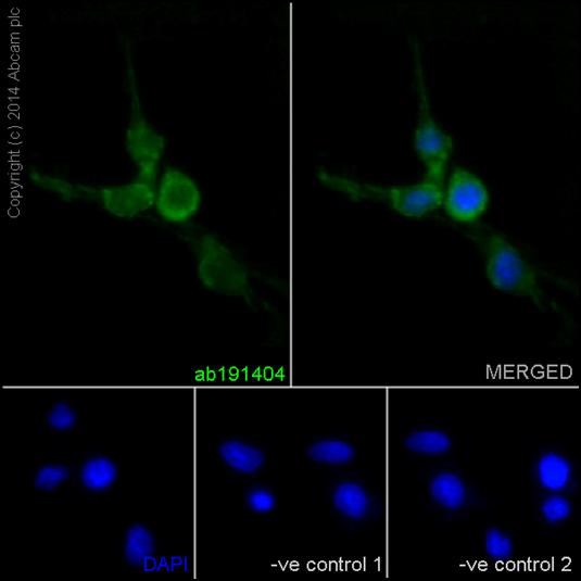 Immunofluorescent analysis of 4% paraformaldehyde-fixed, 0.1% tritonX-100 permeabilized C6 cells labeling Septin 8 with ab191404 at 1/200 dilution, followed by Goat anti-rabbit IgG (Alexa Fluor®488) secondary antibody (ab150077) at 1/200 dilution. Nuclear counter stain DAPI (blue).The two negative controls used anti-Septin 8 primary antibody at 1/200 dilution followed by Goat anti-mouse IgG (Alexa Fluor®594) secondary antibody at 1/400 dilution.
