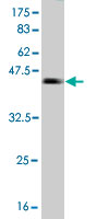 Western blot against tagged recombinant protein immunogen using ab56832 NUDT4 antibody at 1ug/ml.