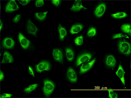 SERBP1 antibody (ab57285) used in immunofluorescence at 10ug/ml on HeLa cells.