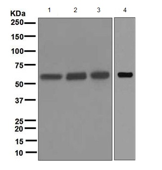 All lanes : Anti-Nicotinic Acetylcholine Receptor alpha 5 antibody [EPR5395] (ab157470) at 1/1000 dilutionLane 1 : A549 cell lysateLane 2 : Jurkat cell lysateLane 3 : A431 cell lysateLane 4 : RAW 264.7 cell lysateLysates/proteins at 10 µg per lane.SecondaryHRP labelled goat anti-rabbit at 1/2000 dilution