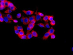 Immunofluorescent analysis of HepG2 cells labelling SERCA2 ATPase with ab137020 at 1/250 dilution.
