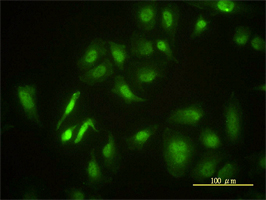 Serine/threonine-protein kinase 4antibody (ab57836) used in immunofluorescence at 10ug/ml on HeLa cells.
