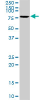 Anti-Serotonin transporter antibody (ab102048) at 1/500 dilution + Mouse lung tissue lysate at 50 µgdeveloped using the ECL technique